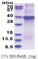 Transducin beta chain 1 / GNB1 (1-340, His-tag) Human Protein