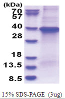Transducin beta chain 1 / GNB1 (1-340, His-tag) Human Protein