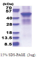 PRKACB (1-398, His-tag) Human Protein