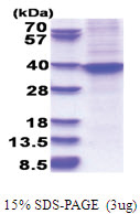 HOXA9 / HOX1G (1-272, His-tag) Human Protein