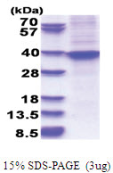 HOXA9 / HOX1G (1-272, His-tag) Human Protein