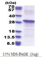 REV1 / REV1L (51-256, His-tag) Human Protein