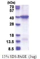 HERC5 (681-1024, His-tag) Human Protein