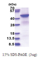 BHMT2 (1-363, His-tag) Human Protein