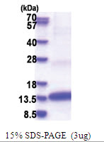 Colipase (18-112, His-tag) Human Protein