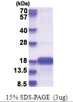 SELH(SC44C) (1-122, His-tag) Human Protein
