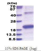 HCV NS5B (2634-2752, His-tag) Human Protein