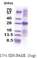 CD298 / ATP1B3 (His-tag) Human Protein