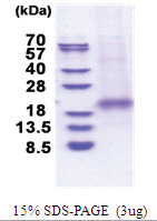 XAF1 (His-tag) Human Protein