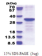 CYB5R2 (1-276, His-tag) Human Protein