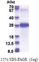 Chondrolectin (22-216, His-tag) Human Protein