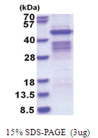 CD66f / PSG1 (35-419, His-tag) Human Protein