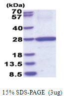 HLA class II DO beta / HLA-DOB (27-224, His-tag) Human Protein