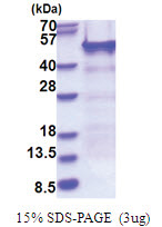 NELF-E (1-380, His-tag) Human Protein