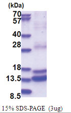 Caspase-2 (348-452, His-tag) Human Protein