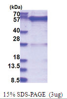 Rab GDI alpha / GDI1 (1-447, His-tag) Human Protein
