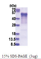 Casein kinase I delta (1-409, His-tag) Human Protein