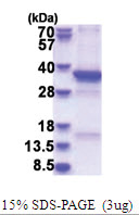 TSFM (46-346, ) Human Protein
