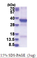 TSFM (46-346, ) Human Protein