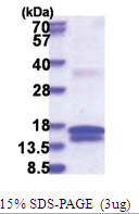 UCK1 (143-273, His-tag) Human Protein