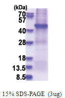 AFAP1 (250-590, His-tag) Human Protein