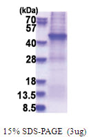 AFAP1 (250-590, His-tag) Human Protein