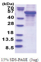 Adipophilin / ADFP (1-437, T7 tag) Human Protein