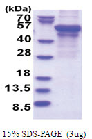 Adipophilin / ADFP (1-437, T7 tag) Human Protein