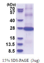 CD200 (31-232, His-tag) Human Protein