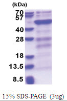 DNMT3L (1-386, His-tag) Human Protein