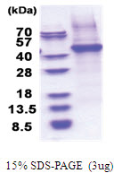 CD14 (His-tag) Human Protein