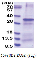 CNPY4 (22-248, His-tag) Human Protein