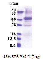 PIM2 (1-311, His-tag) Human Protein