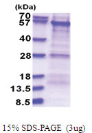 PKNOX1 (1-436, His-tag) Human Protein
