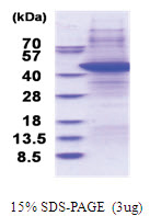 TARBP2 (1-345, ) Human Protein