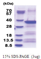 EXOSC3 (1-275, His-tag) Human Protein