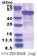 ZCCHC12 (1-402, His-tag) Human Protein