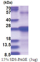 SDF2 (19-211, His-tag) Human Protein