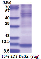 NDUFA4 (1-81, His-tag) Human Protein
