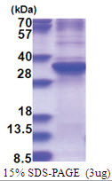 ZNF32 (1-273, His-tag) Human Protein