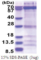 ZWILCH (1-591, His-tag) Human Protein