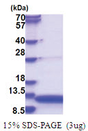 GNRH1 / Progonadoliberin-1 (24-92, His-tag) Human Protein