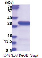 RANBP3 (235-445, His-tag) Human Protein