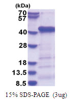 APG3 / ATG3 (1-314, His-tag) Human Protein