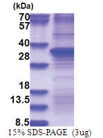 Hepatocyte growth factor / HGF (32-285, recombinant, His-tag) Human Protein