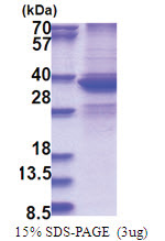 DDX39 (1-249, His-tag) Human Protein
