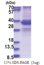 DDX39 (1-249, His-tag) Human Protein