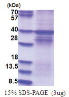 DYRK1A (159-479, His-tag) Rat Protein