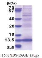MLLT11 / AF1Q (1-90, His-tag) Human Protein