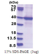STRAD alpha / LYK5 (1-314, His-tag) Human Protein